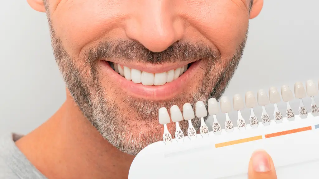 Porównanie wybielania zębów – zabieg wybielania zębów w gabinecie stomatologicznym z użyciem profesjonalnych narzędzi.