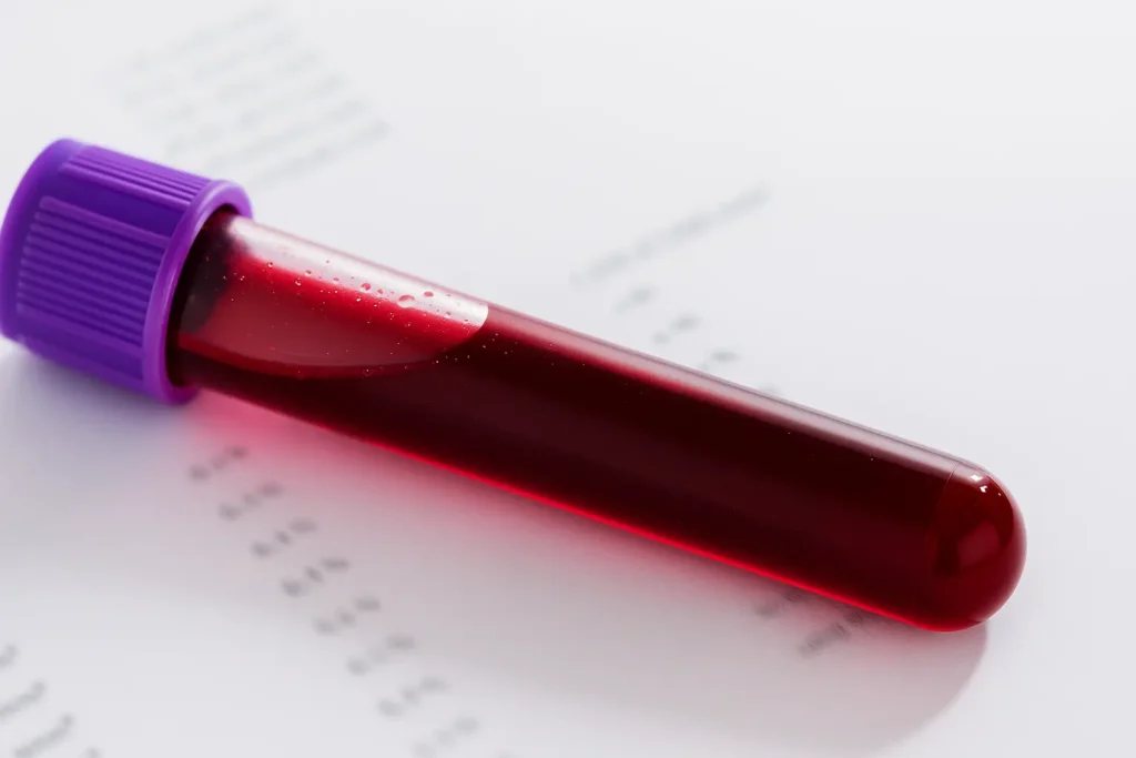 Badanie krwi – morfologia i panel tarczycowy w diagnostyce zdrowia, jak często je wykonywać?